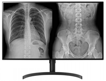 LG 32HL512D 32" DIAGNOSTIC UHD IPS HAS DP/HDMI